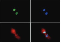 H3R2me2(sym)K4me2 | Histone H3 (sym-dimethylated Arg2, dimethyl Lys4) in the group Antibodies Plant/Algal / DNA/RNA/Cell Cycle / Epigenetics/DNA methylation at Agrisera AB (Antibodies for research) (AS16 3185)